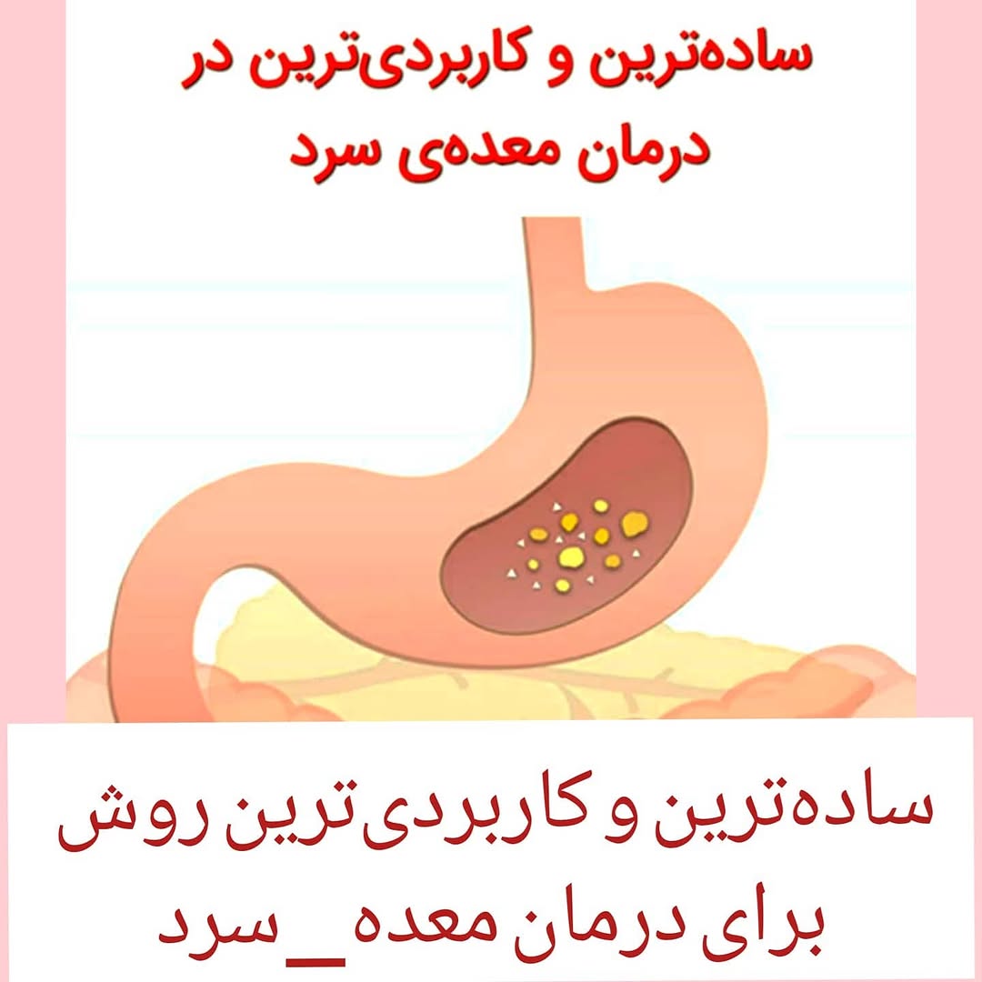 پست اینستاگرام CGQKrMRJaBT