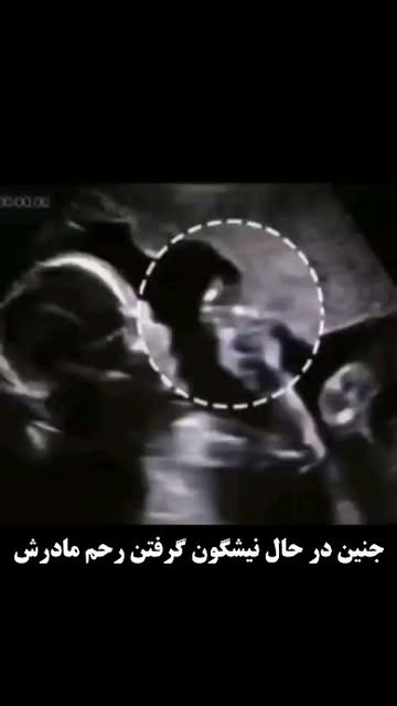پست اینستاگرام Ct6n21Igdh1