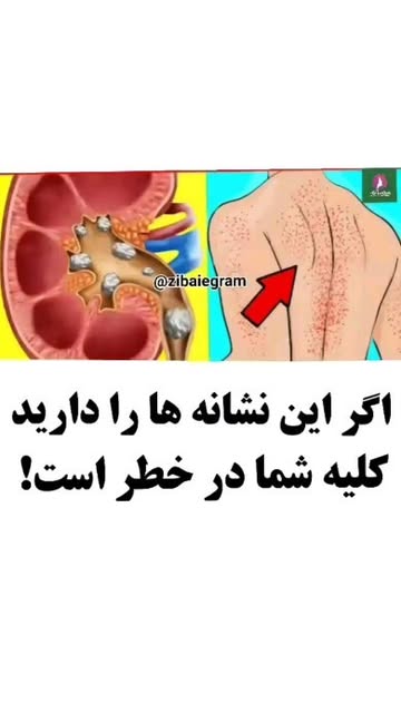 پست اینستاگرام CunDp1ANMWc