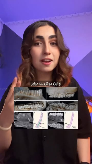 پست اینستاگرام DSsLsj3DP8E