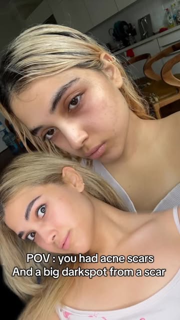 پست اینستاگرام DYhVDFVsooQ