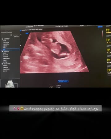 پست اینستاگرام Da-b0Y1BLaU