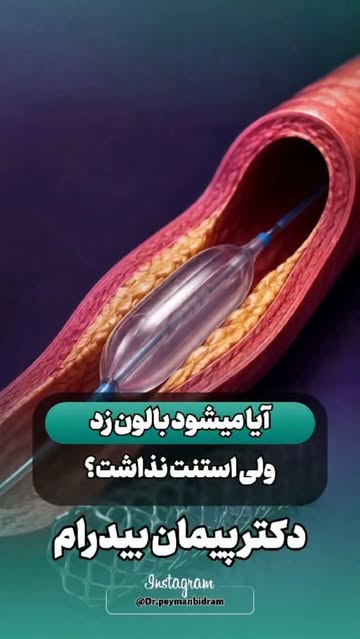 پست اینستاگرام Da2j402NJsK