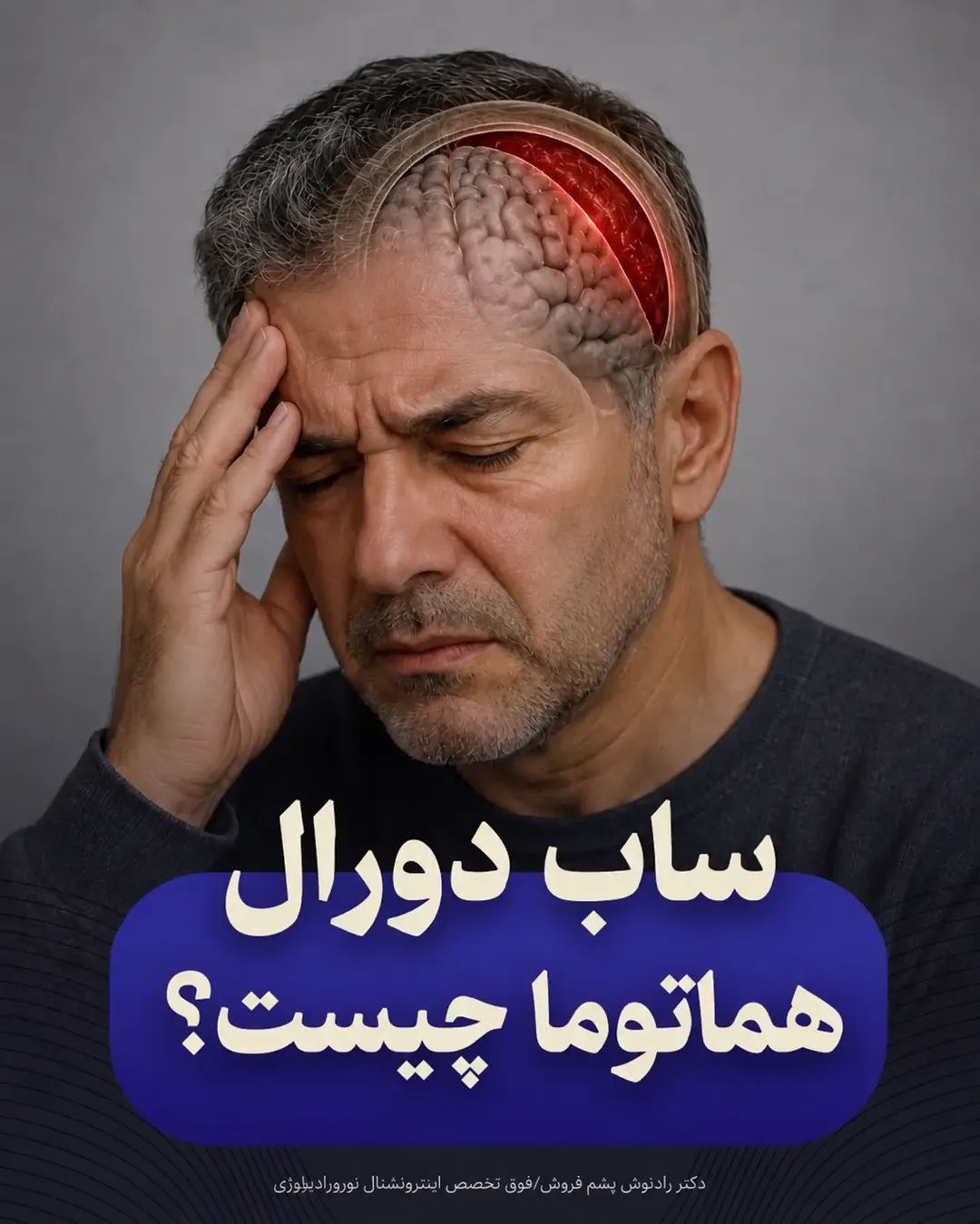 پست اینستاگرام Da5pZWFgoK3