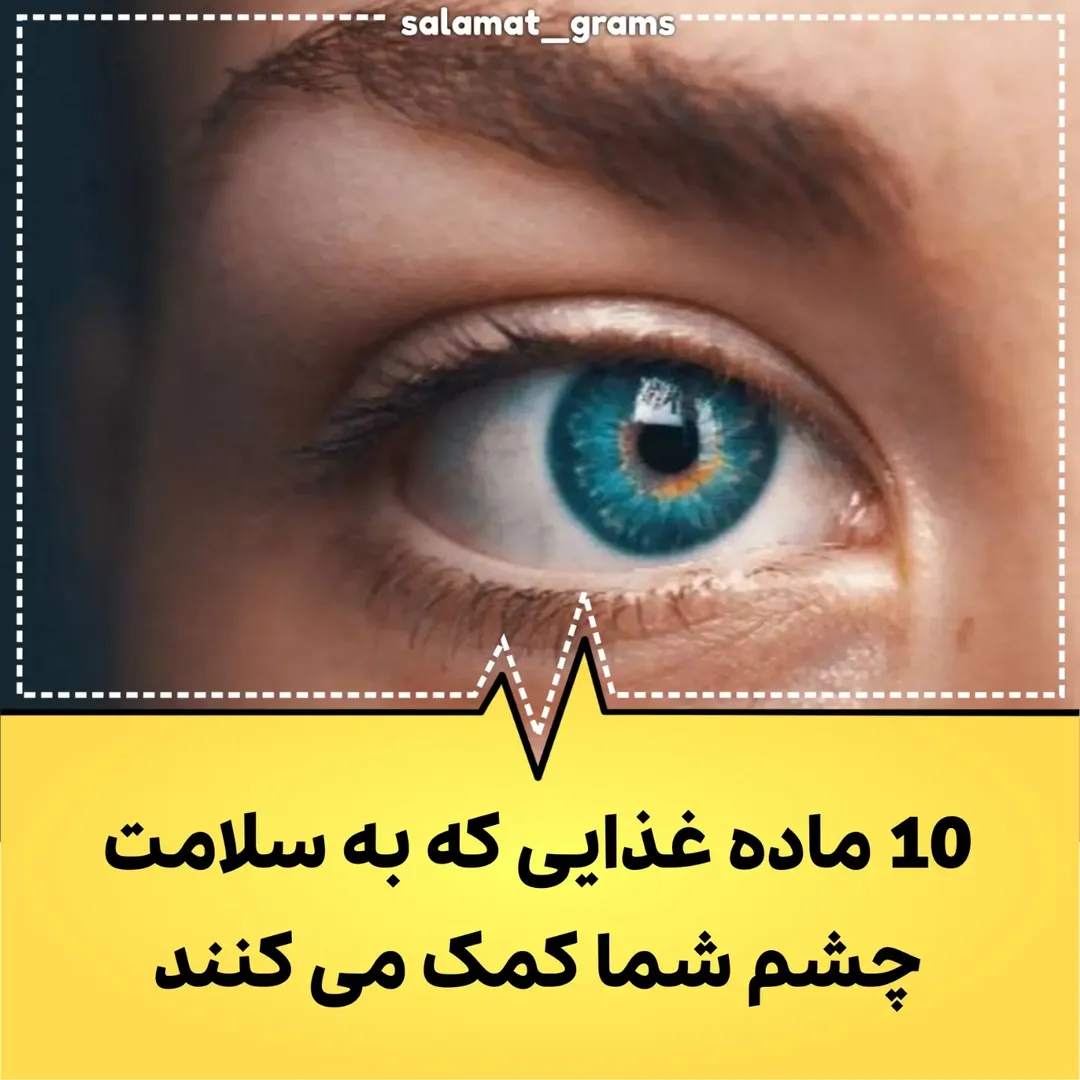 پست اینستاگرام DaLNGHJMSQ-