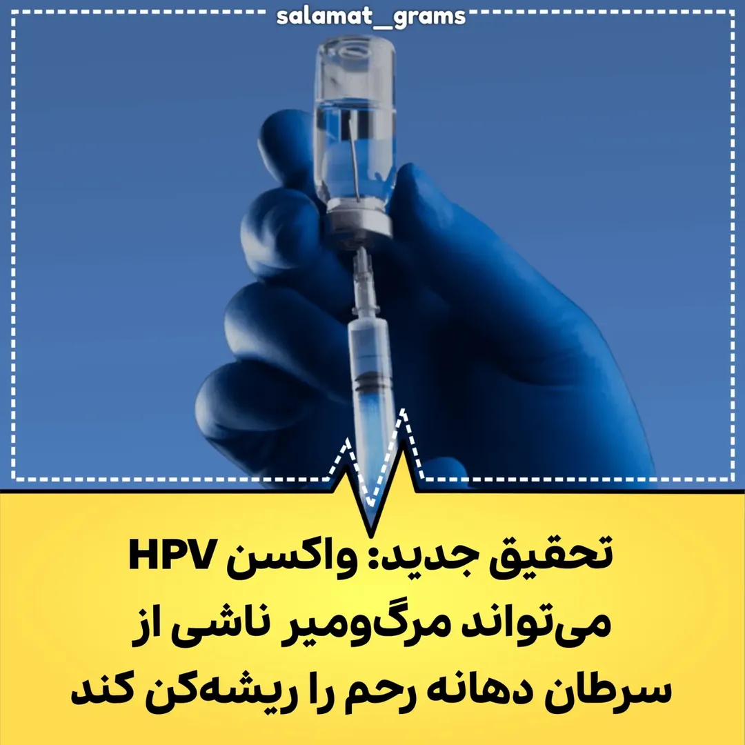 پست اینستاگرام Daayowtsv35