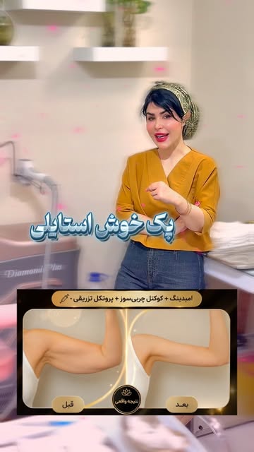 پست اینستاگرام Db-K1_0tv8p