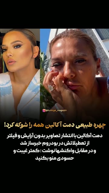پست اینستاگرام Db1BLu2hcIH