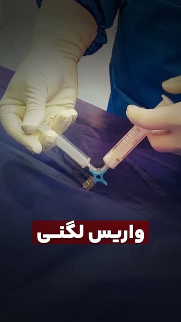 پست اینستاگرام Db6PeWntM9H