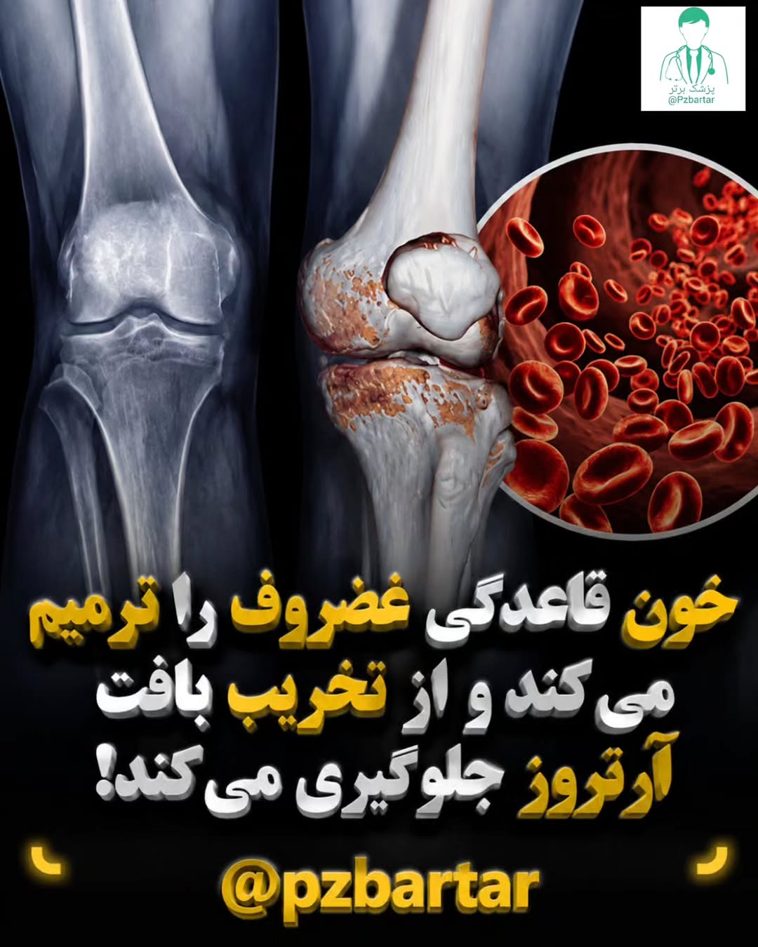 پست اینستاگرام Db9FmZayz8T