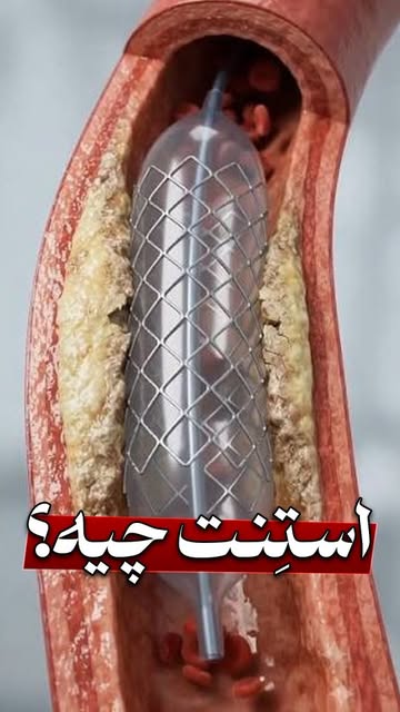پست اینستاگرام DbBjAMIt0mJ
