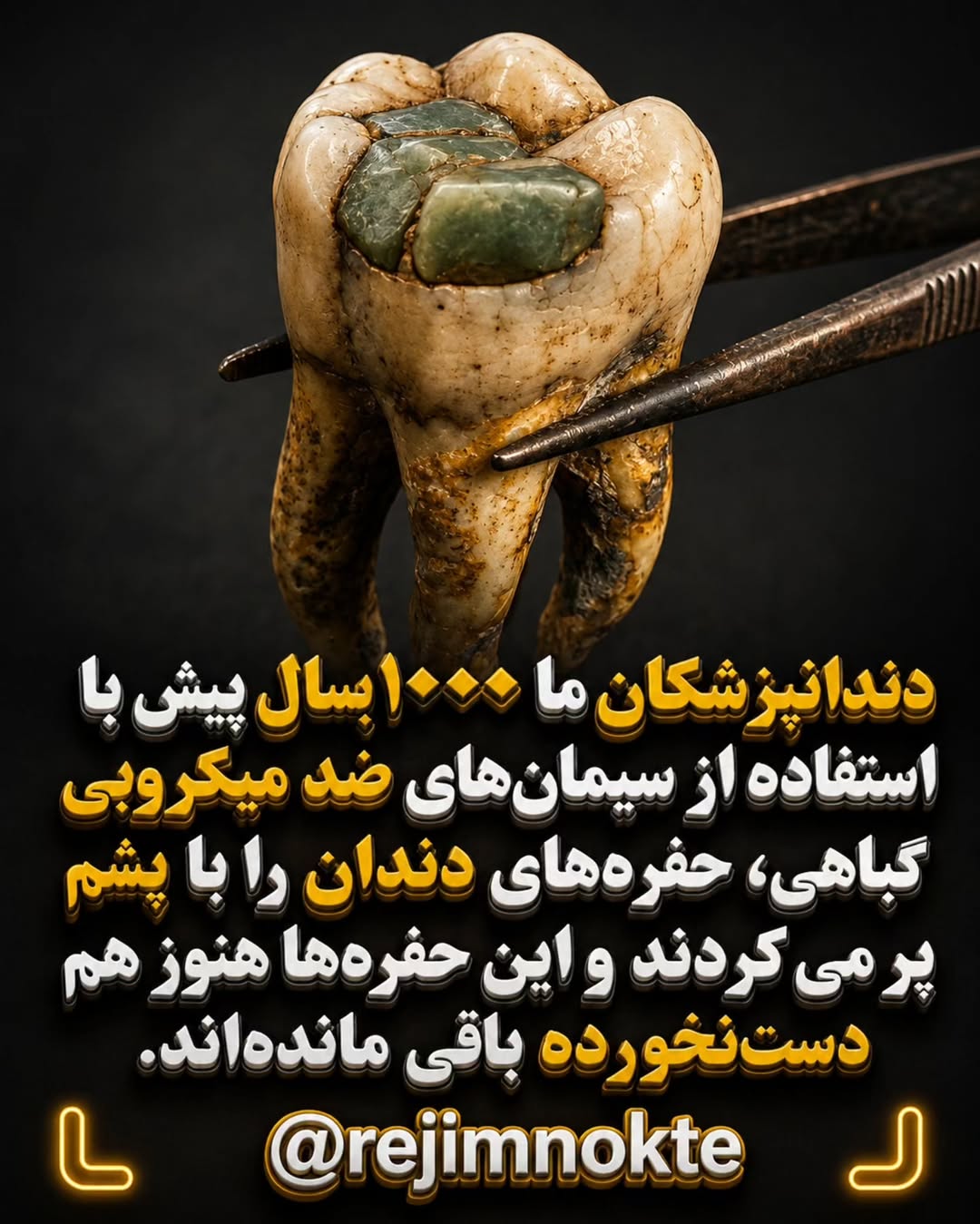 پست اینستاگرام Db_7AolMN6w