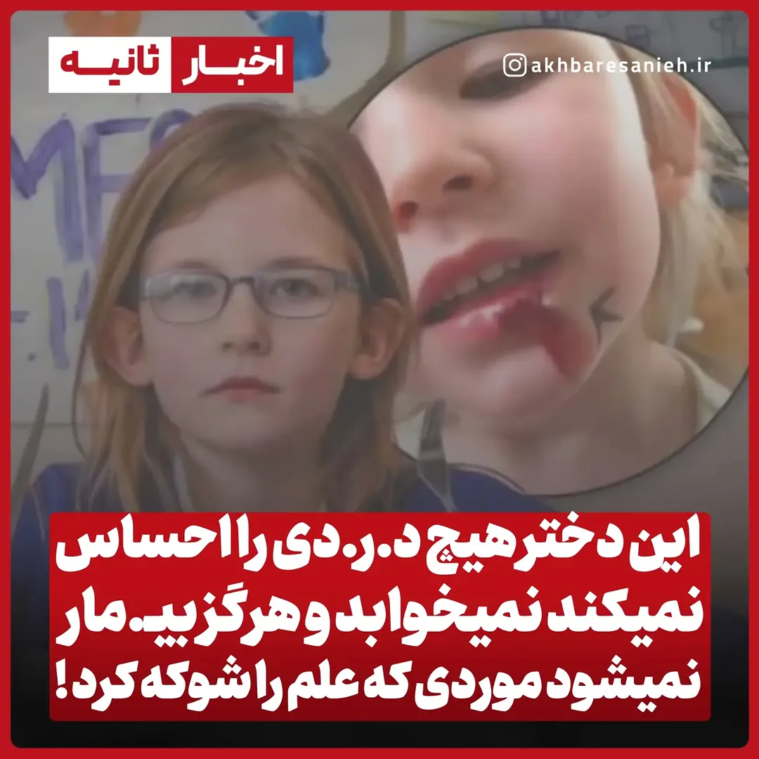 پست اینستاگرام Db_kgTzo6an