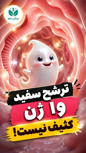 پست اینستاگرام DbaOpT3oLR1