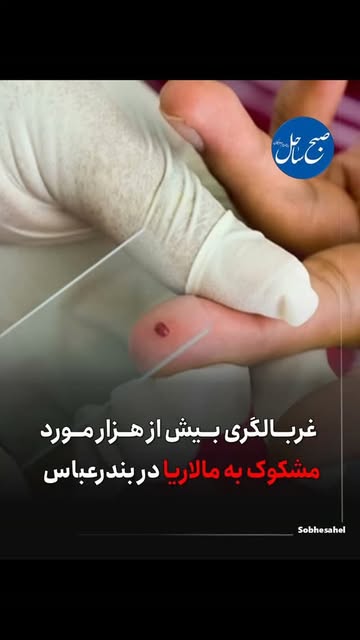 پست اینستاگرام DbfNkEjoJly