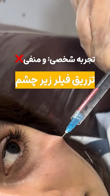 پست اینستاگرام DbkiBobJruO