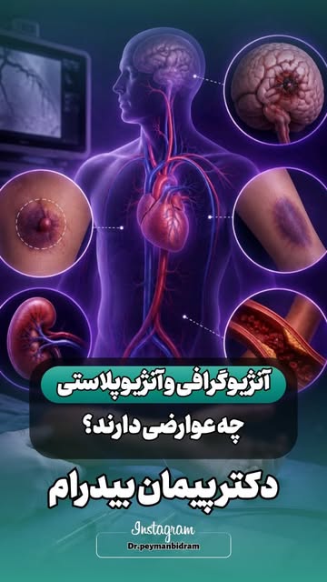 پست اینستاگرام Dbqyj7Zt3tE