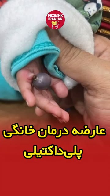 پست اینستاگرام DbtWdNEunxT