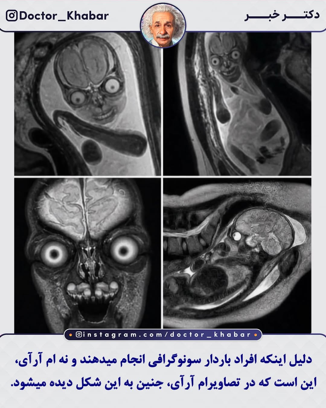 پست اینستاگرام Dbv-PsCIXdz