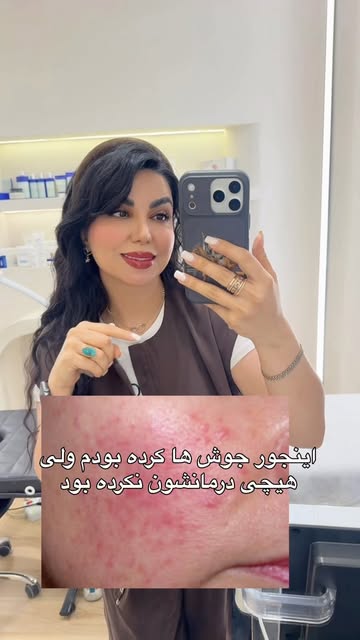 پست اینستاگرام DbvBVZCIAb2