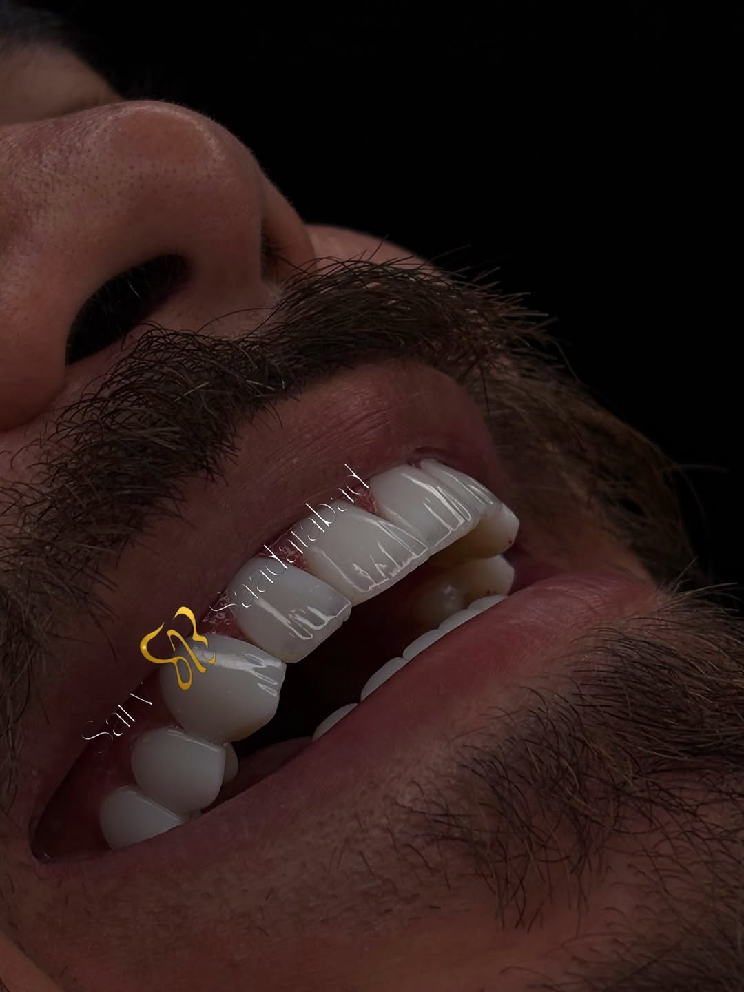 پست اینستاگرام DbyTgdVgtym