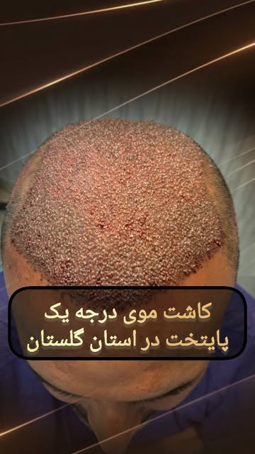 پست اینستاگرام DbyWzKSod3f