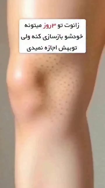 پست اینستاگرام DbyuYhVsUwy