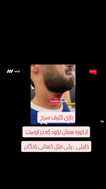 پست اینستاگرام Dc10xqdqbAb