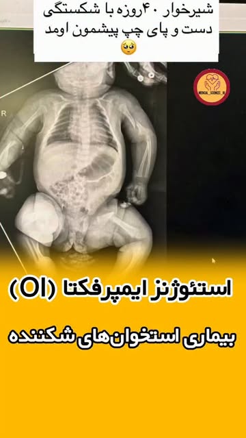پست اینستاگرام DcA9iqXsZgu