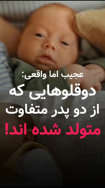 پست اینستاگرام DcB2KR2hanN