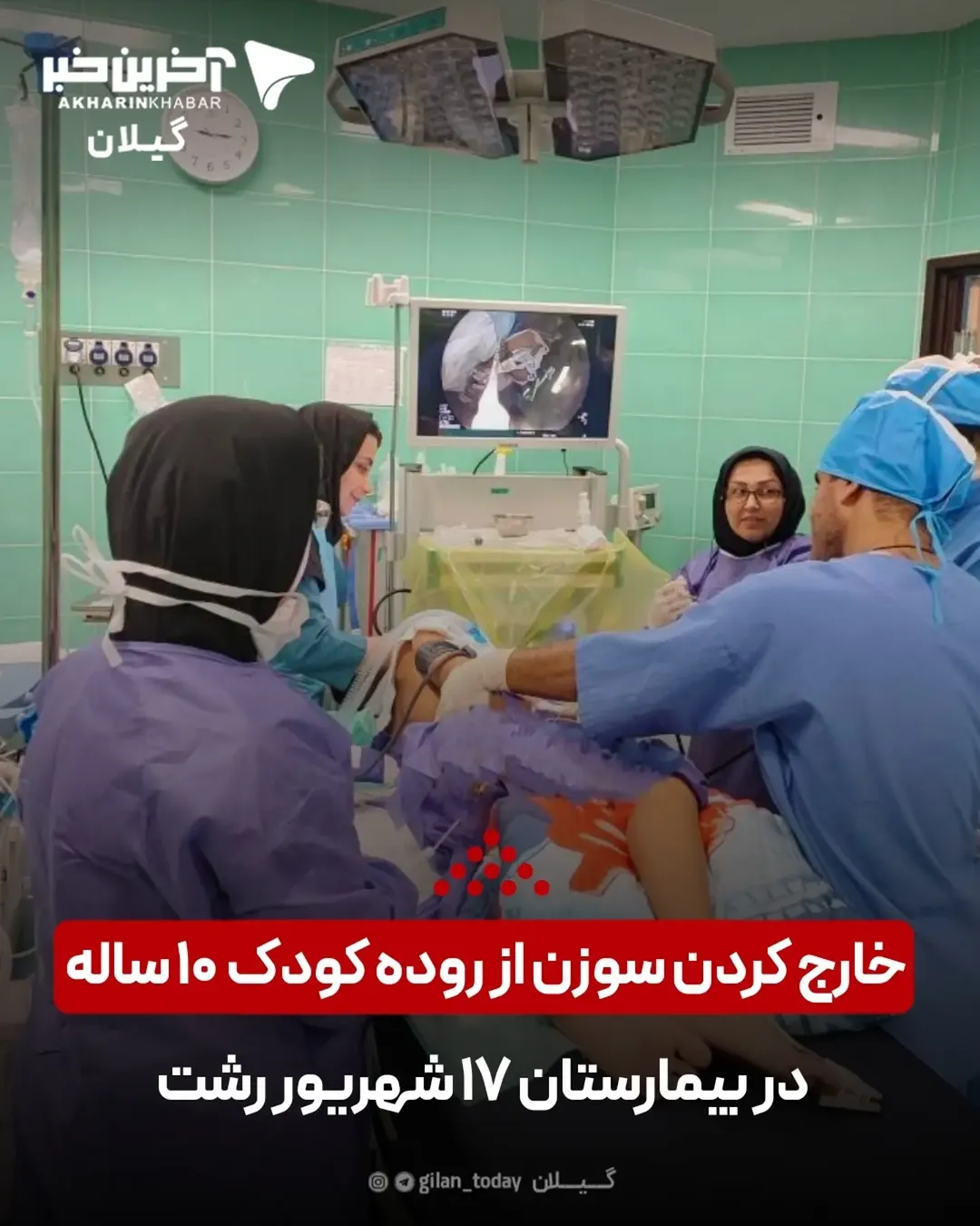 پست اینستاگرام DcDeVr-OQ_U