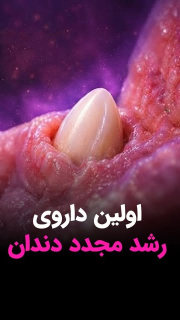 پست اینستاگرام DcG2NPFs8dz