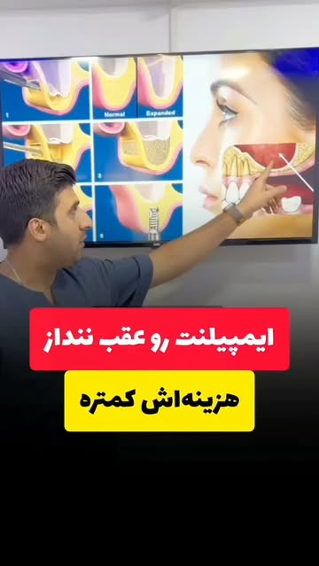 پست اینستاگرام DcGQYVGsOZD