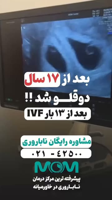 پست اینستاگرام DcJC_HhibPG