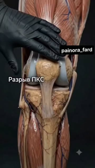 پست اینستاگرام DcMQ7CmJ0Qu
