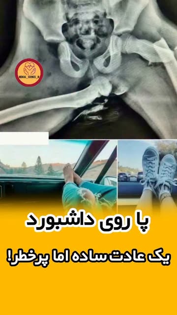 پست اینستاگرام DcNyHwNMVUR