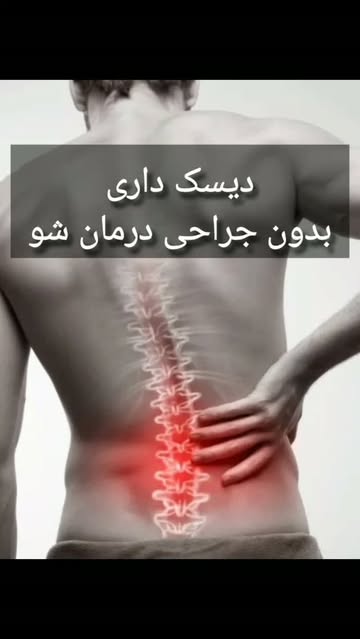 پست اینستاگرام DcONabeMPXK