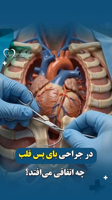پست اینستاگرام DcWIZZKh--h