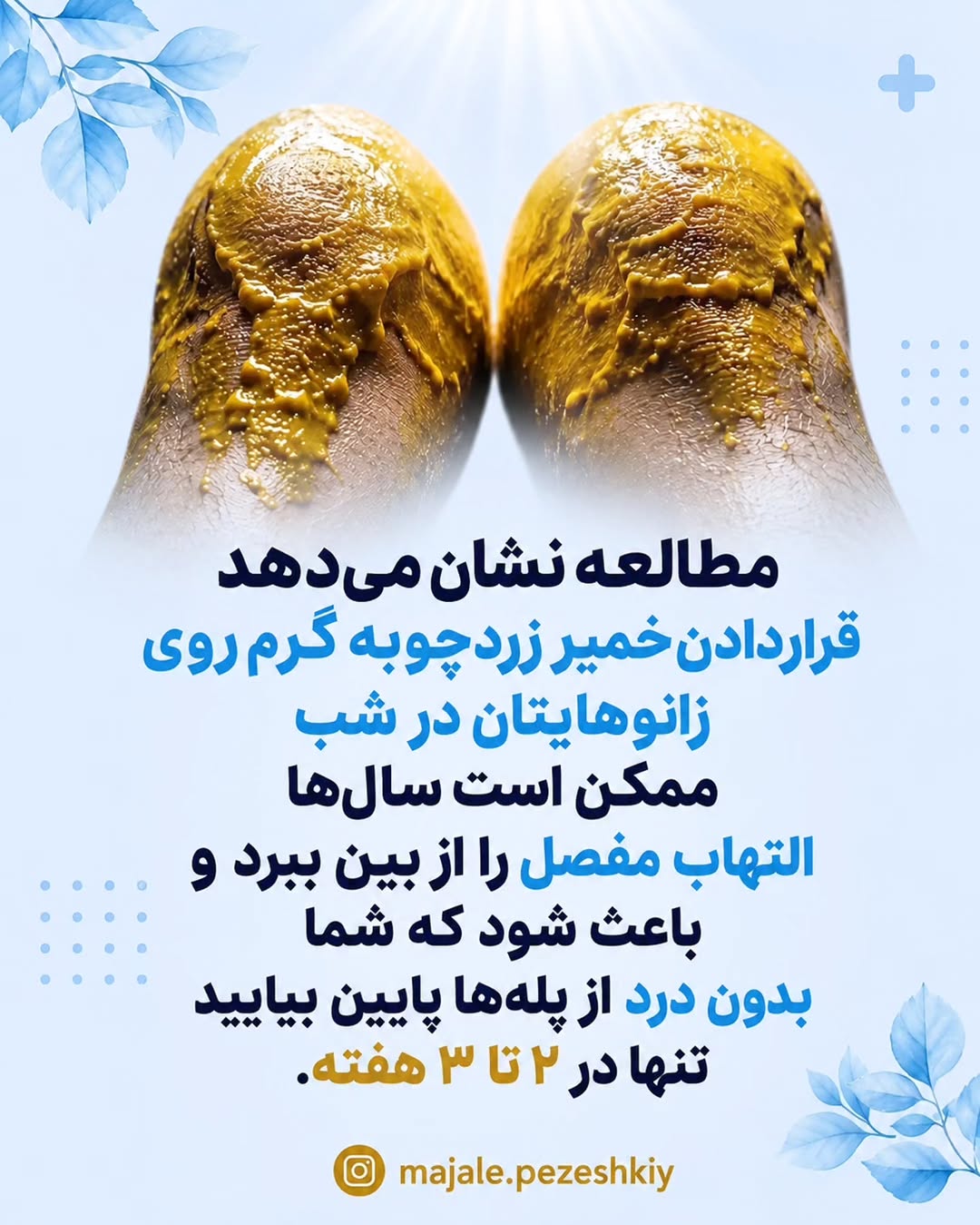 پست اینستاگرام DcawD7hDFMf