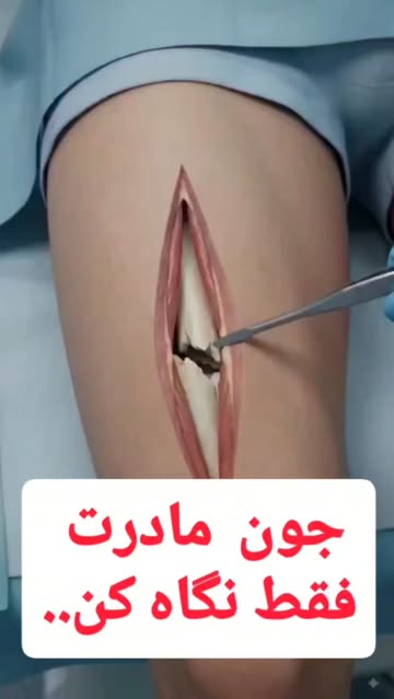 پست اینستاگرام DcbteveNkCG