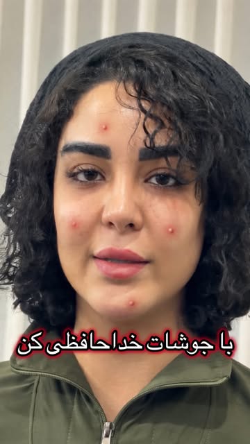 پست اینستاگرام DceBtYhIsXg