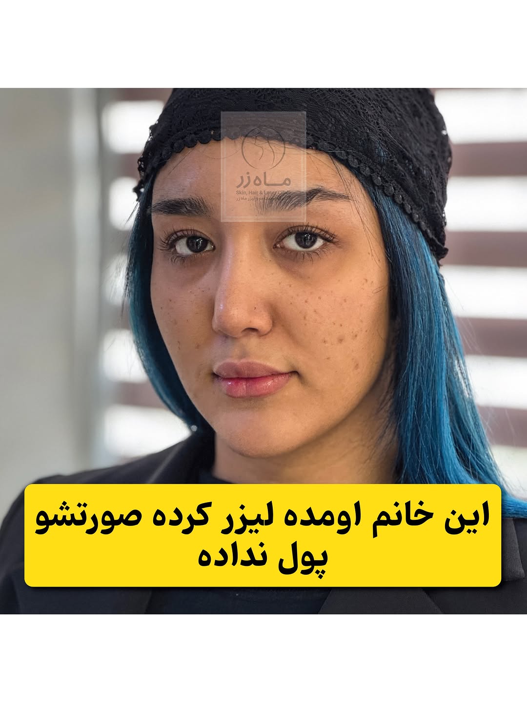 پست اینستاگرام DceKPtdCN8E