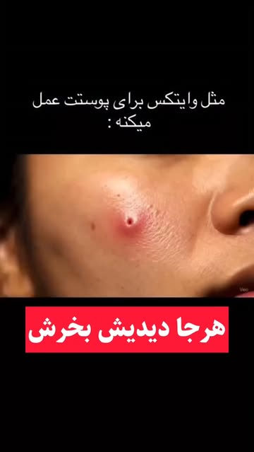 پست اینستاگرام Dck-zBVtvCs