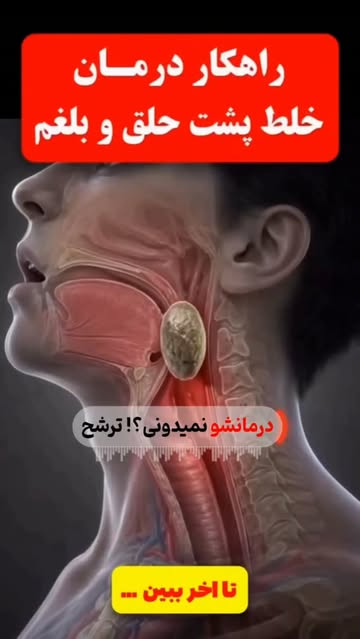 پست اینستاگرام Dck7kXeRfM5