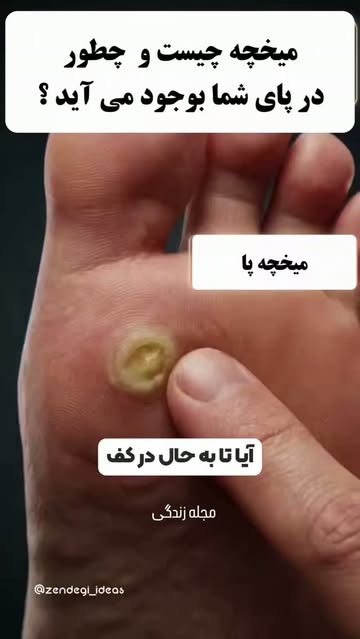 پست اینستاگرام DckpIBAM1hf