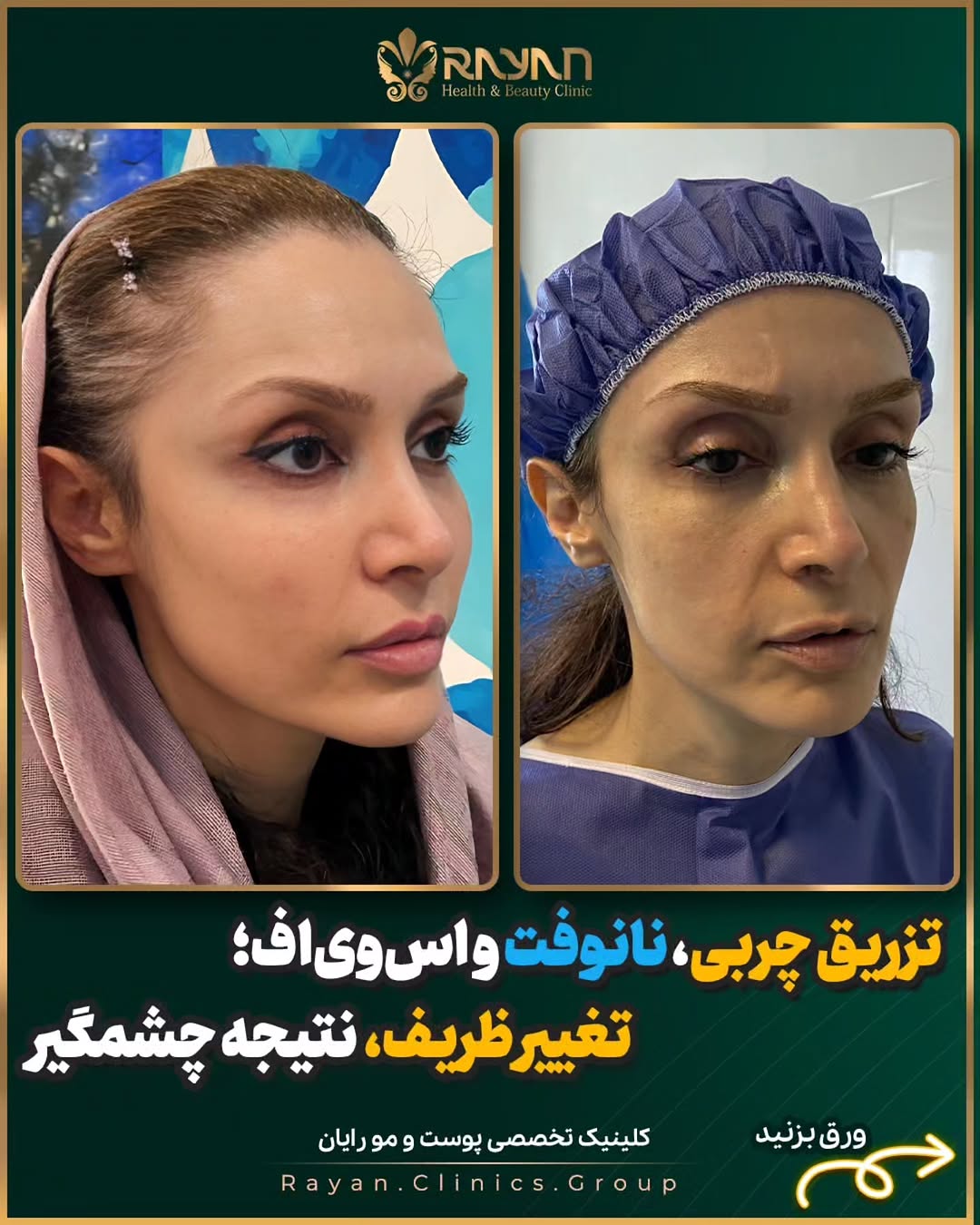 پست اینستاگرام Dckve6FiLG3