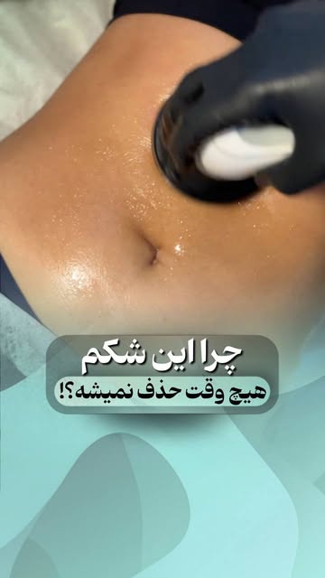 پست اینستاگرام DcqUEF4NENX
