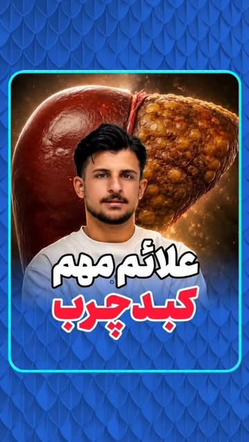 پست اینستاگرام DcrDMiOtAOM