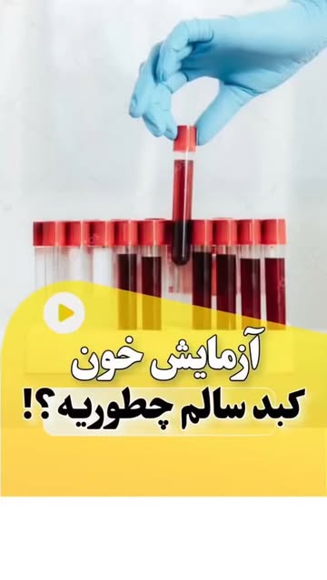 پست اینستاگرام DcrDl8coRyS