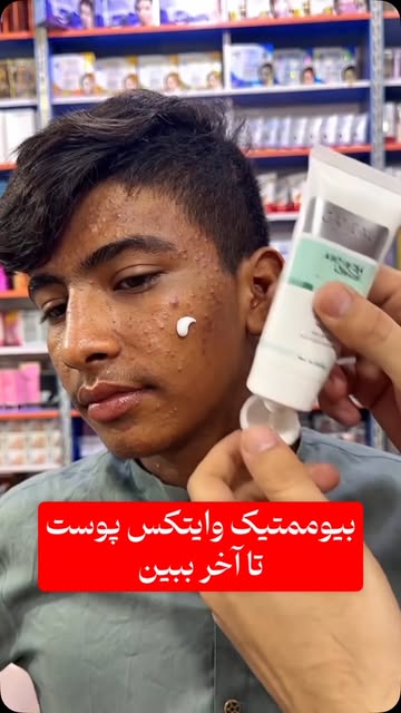 پست اینستاگرام DcrTaUmIq4N